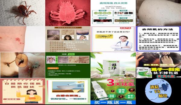 白醋去阴虱子*快的方法 - 汕头白醋去阴虱*快的方法