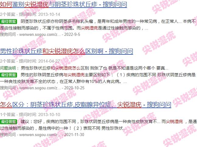 广东汕头珍珠膏好不好 - 汕头怎么确诊珍珠疹和尖锐湿疣