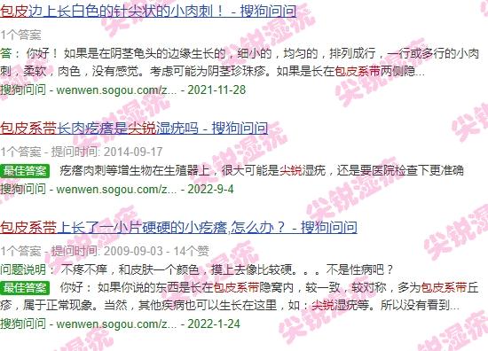 包皮系带 尖锐 - 汕头尖锐长包皮系带