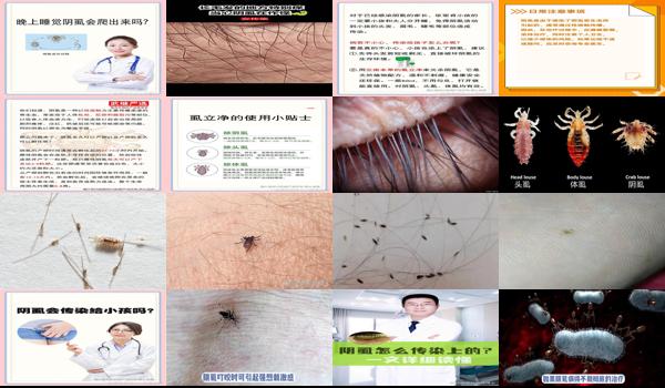 汕头得了阴虱的人多吗 - 汕头得了阴虱同睡的孩子会传染吗