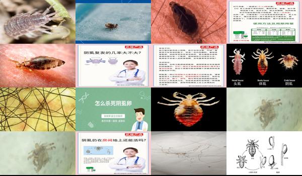 阴虱卵在床上能存活多久 - 汕头阴虱卵在床单存活多久