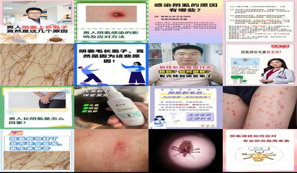 男生为什么得阴虱 - 汕头男人为什么容易长阴虱