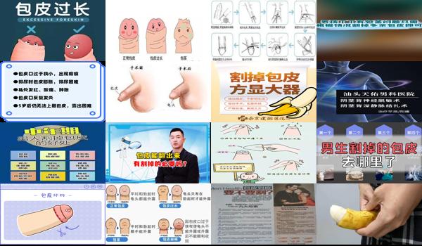 汕头为什么要割掉包皮的医院 - 汕头为什么要割掉包皮