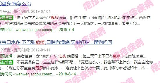 疱疹可以洗头洗澡吗 - 汕头疱疹能洗澡吗