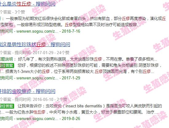 头皮炎症性丘疹 - 汕头炎症性丘疹图片