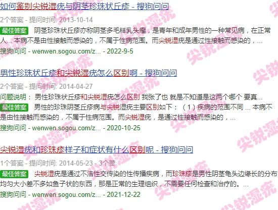 汕头珍珠膏哪个牌子好 - 汕头珍珠疹和尖锐湿区分图
