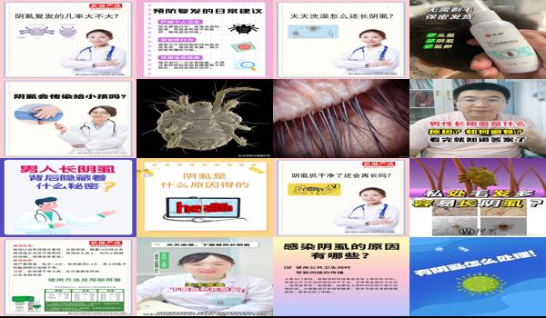 汕头男科医院 - 阴虱
